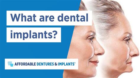 affordable dentures in this area